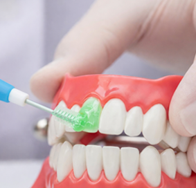 아이콘 레진 도포