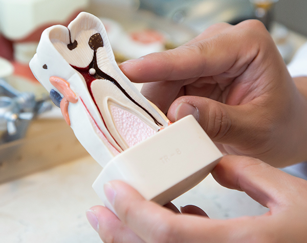 소중한 자연치아를 지키는 치료