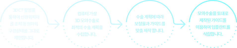  네비게이션 임플란트